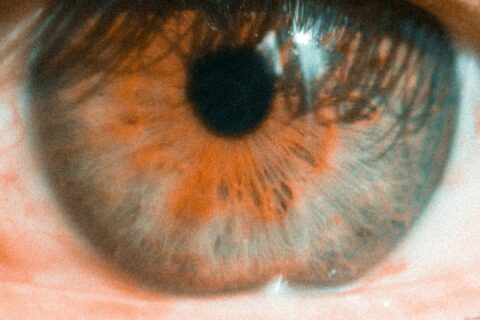 persons brown and black eye