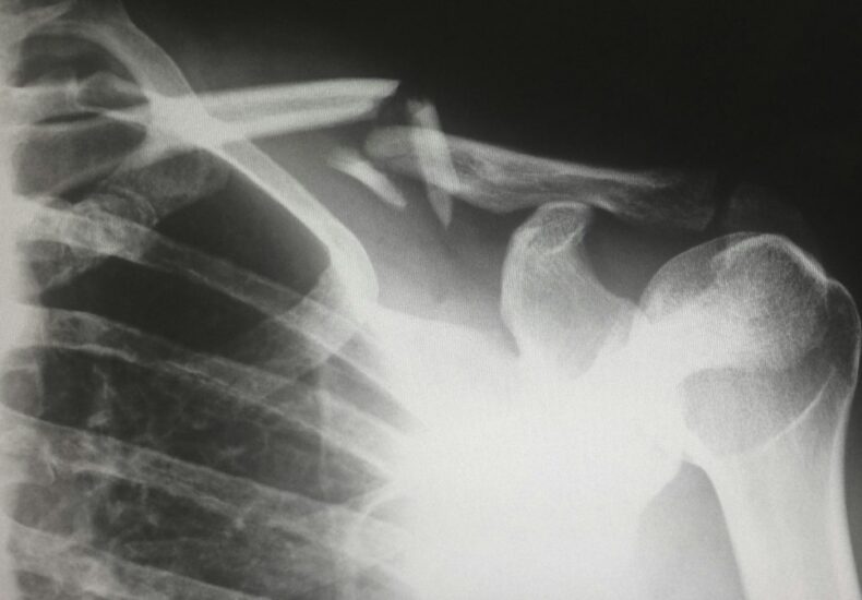human X-ray result chart